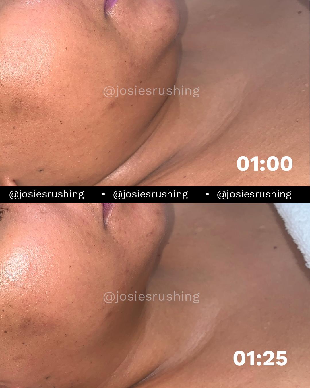 Facial 1