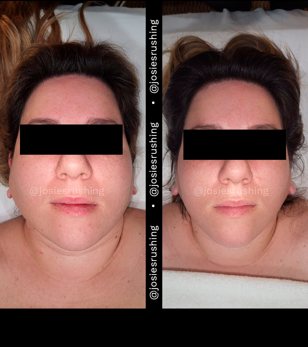 Facial 4