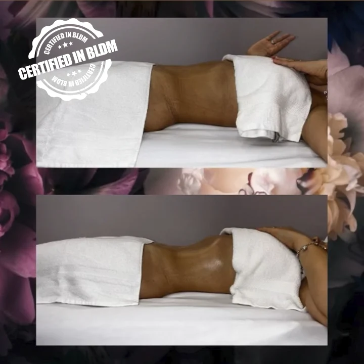 Before and After - Brazilian Lymphatic Drainage