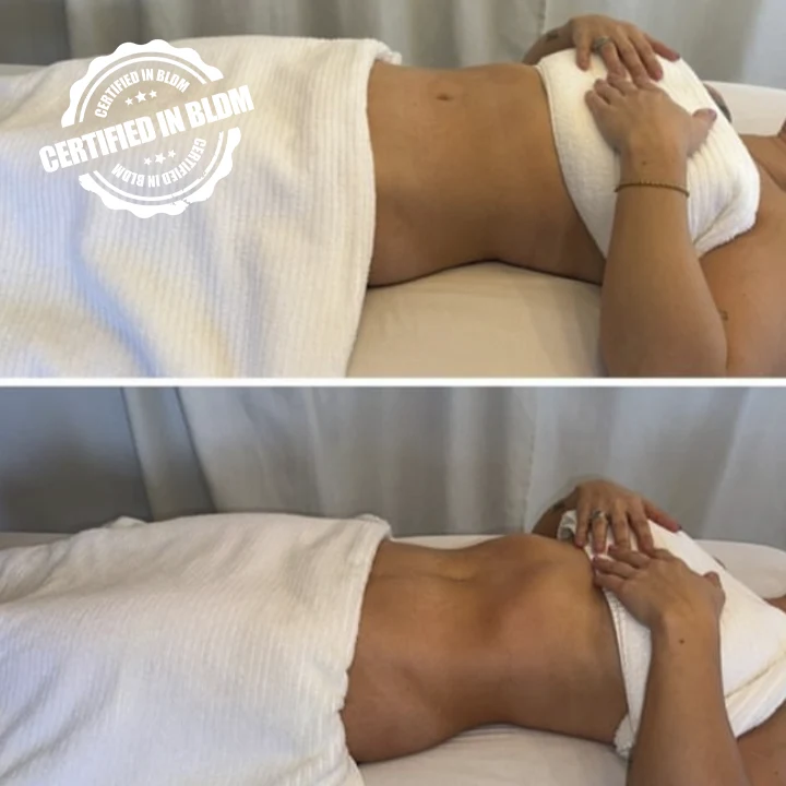 Before and After - Brazilian Lymphatic Drainage