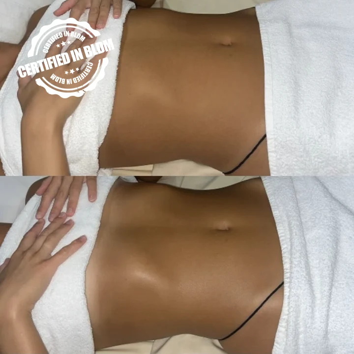 Before and After - Brazilian Lymphatic Drainage