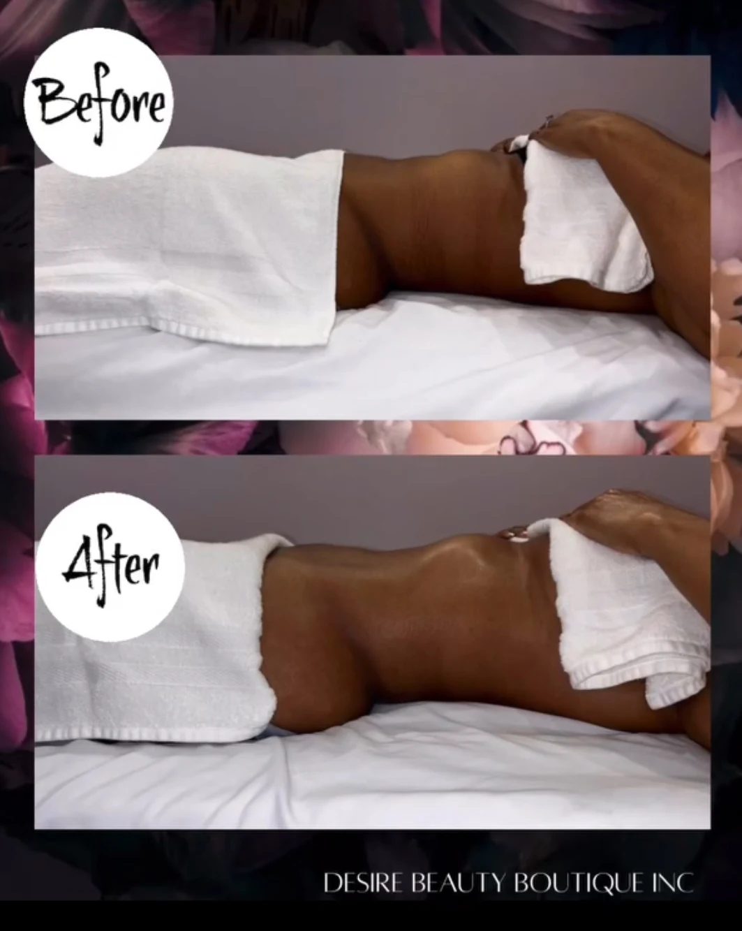 Before-and-after-Students-Alunas-11.webp
