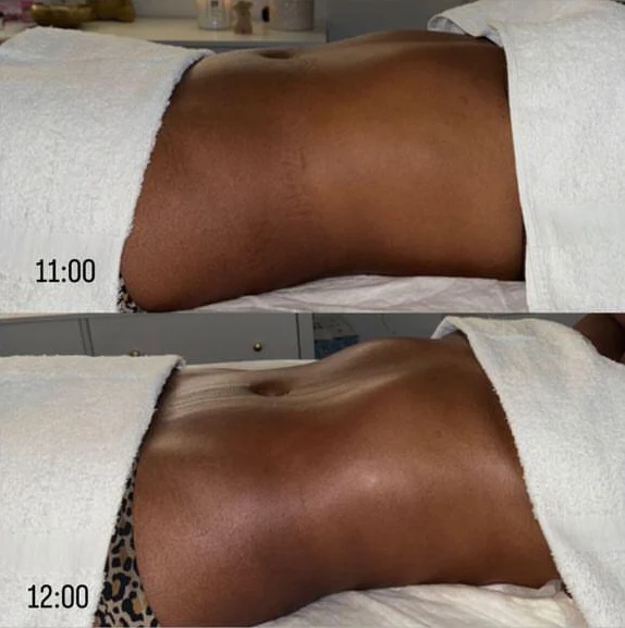 Before-and-after-Students-Alunas-4.webp