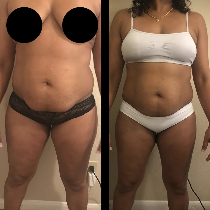 Before and after 10