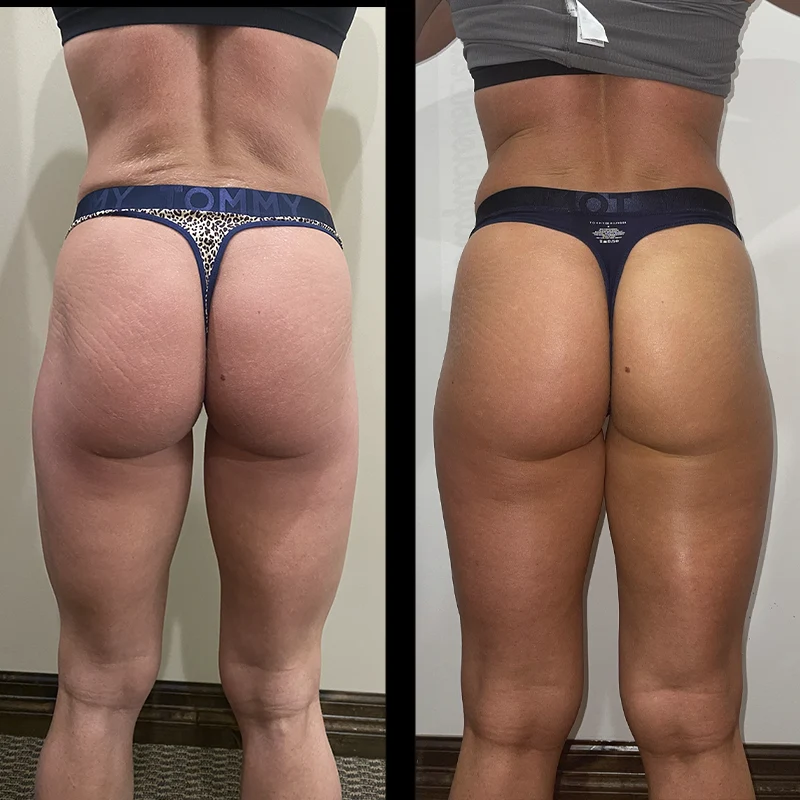 Before and after 11