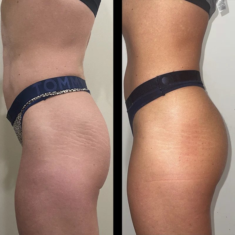 Before and after 12
