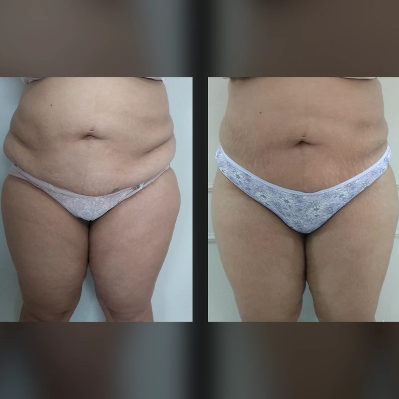 Before and after 2