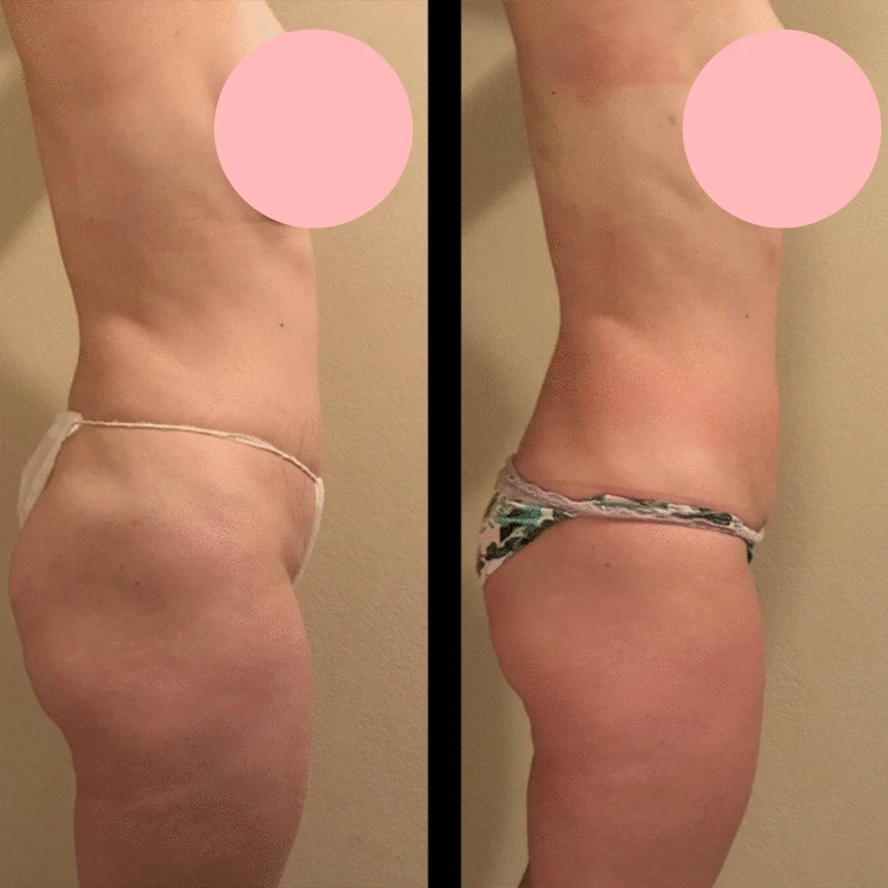 Before and after 3