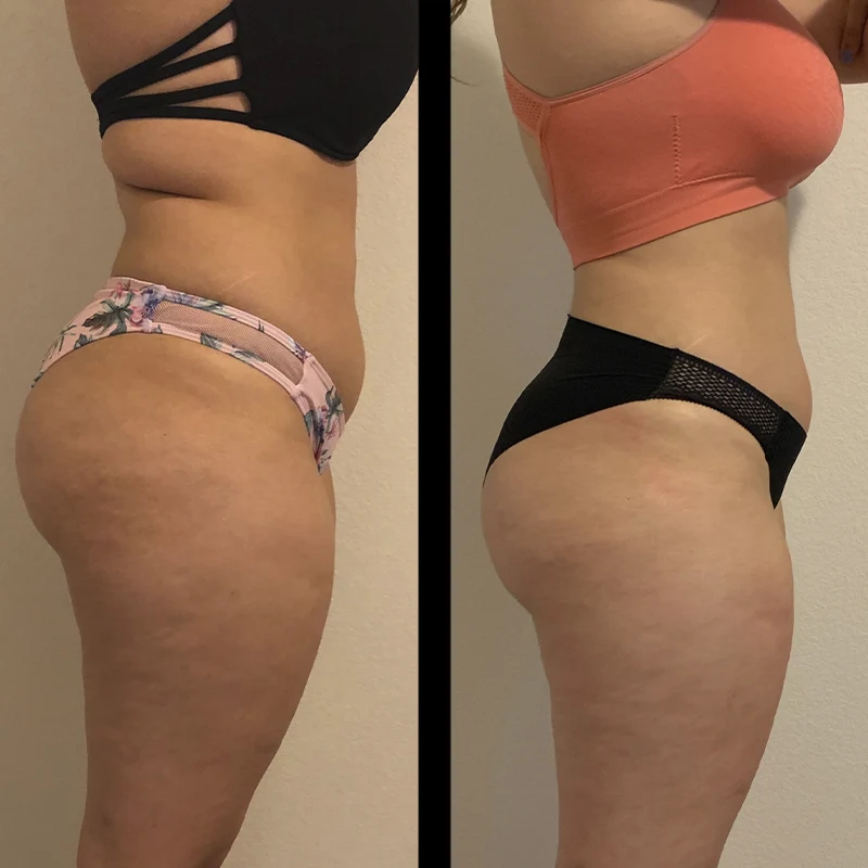 Before and after 4