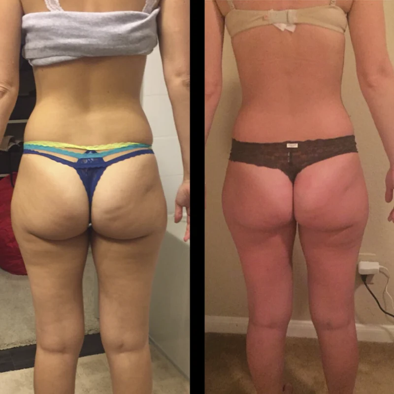 Before and after 5