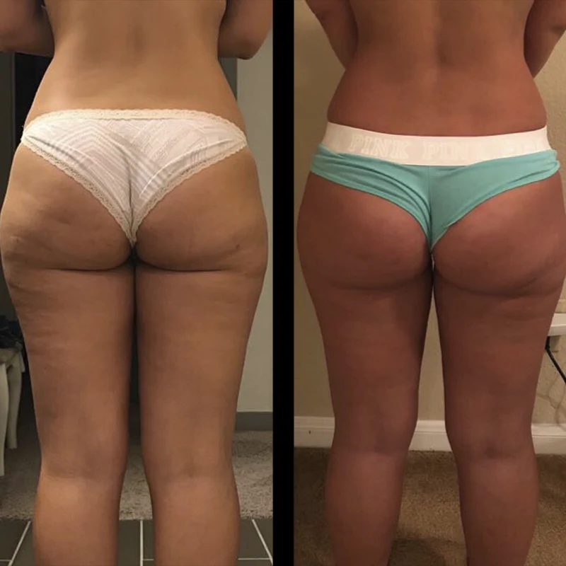 Before and after 6