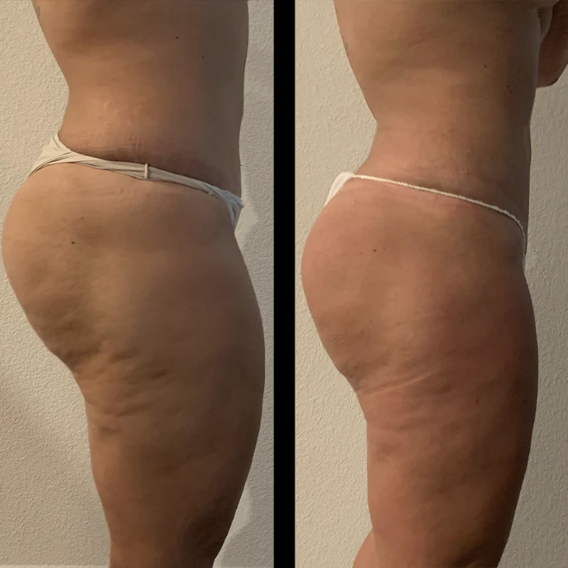 Before and after 7