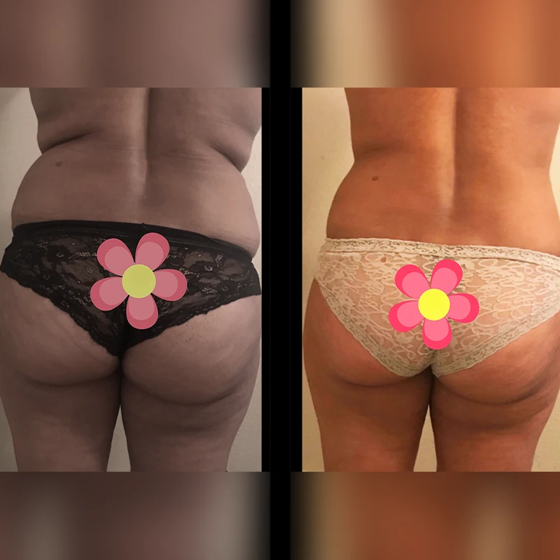 Before and after 8