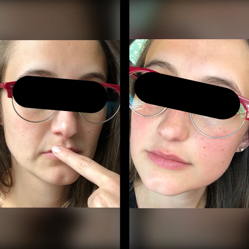 Before and after 9