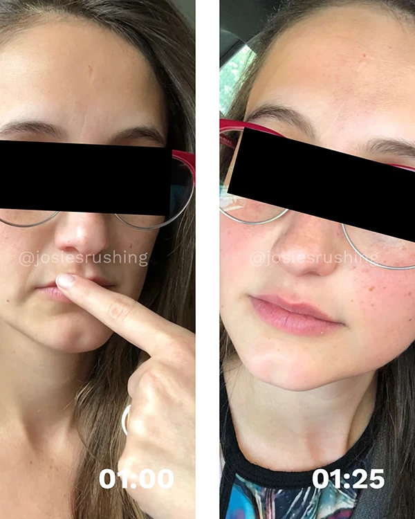 Before and After - Face